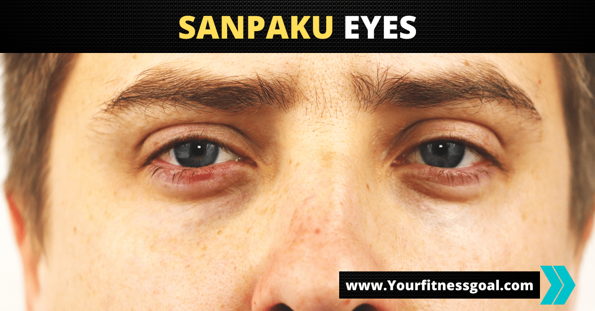 Sanpaku eyes