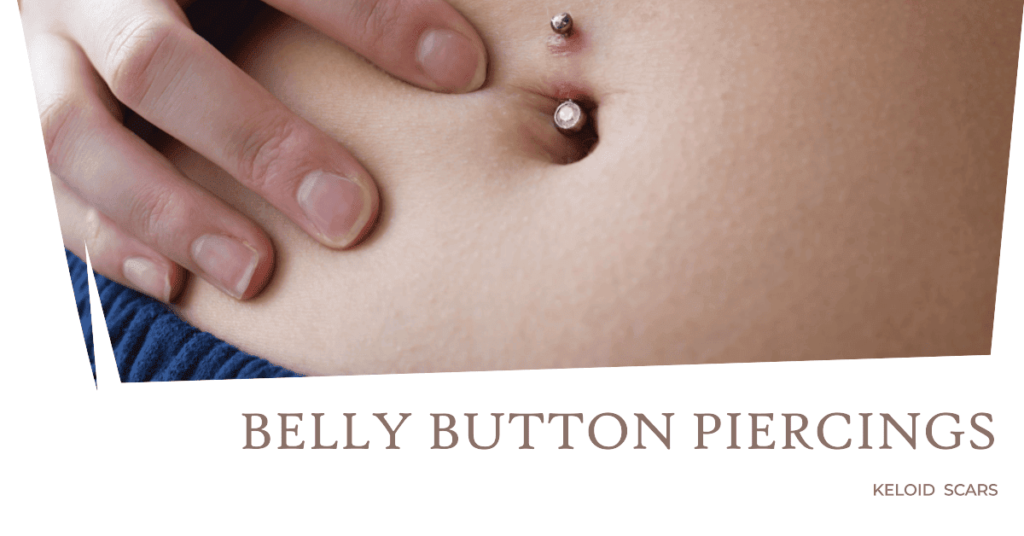 belly button piercing keloid