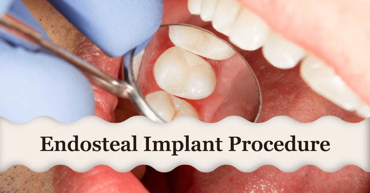 endosteal implant