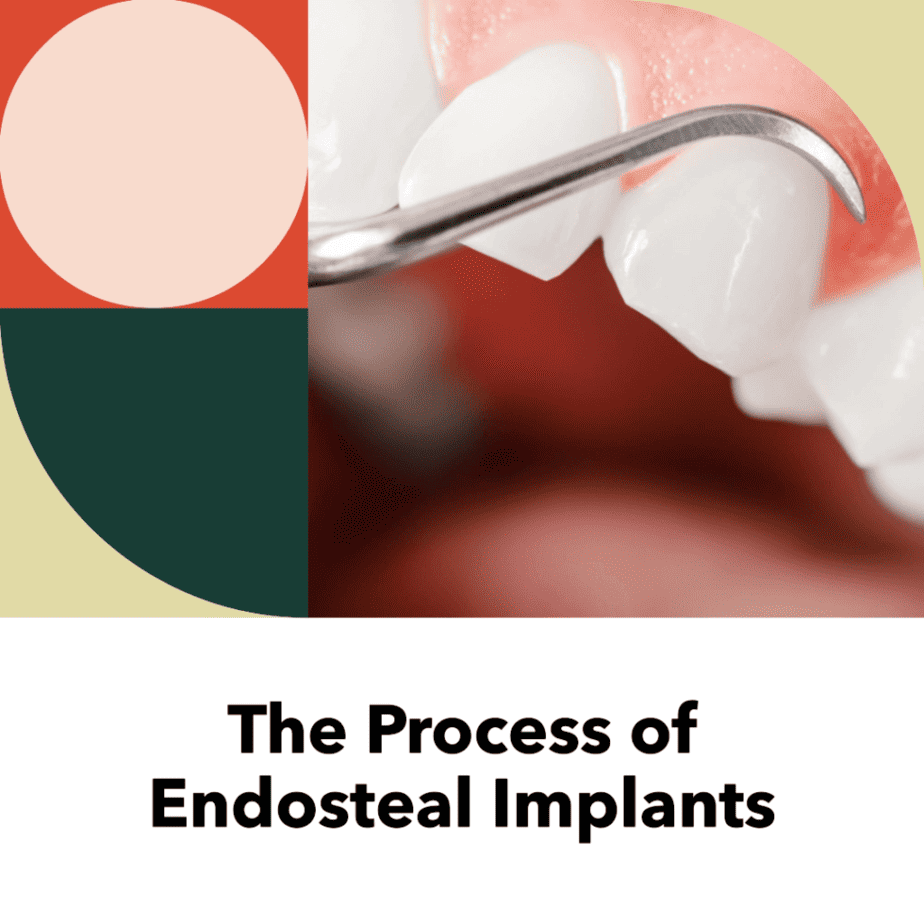 endosteal implant
